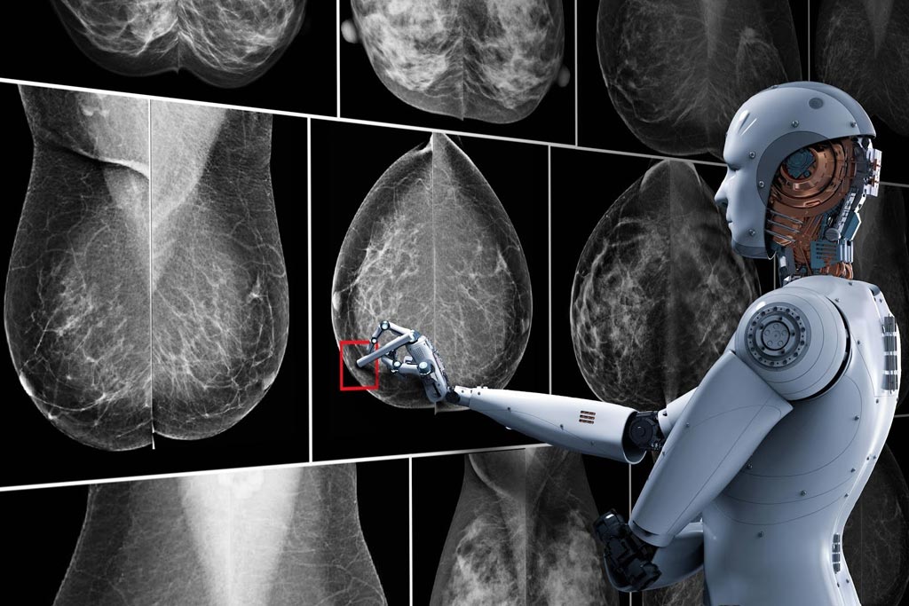 Breast Cancer Image Dataset