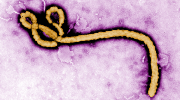 Ebola Virus Disease: An Evolving Epidemic